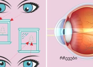 სავარჯიშოები თვალის კუნთების გასაძლიერებლად და მხედველობის გასაუმჯობესებლად