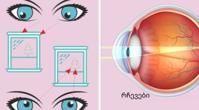 სავარჯიშოები თვალის კუნთების გასაძლიერებლად და მხედველობის გასაუმჯობესებლად