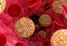 გაარკვიეთ, რატომ გვჭირდება ცხიმები: 4 ფუნქცია ორგანიზმში. ცხიმების მნიშვნელობის გაცნობიერებით, მათ შეგნებულად არ აიცილებთ უცხიმო დიეტის დროს.