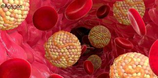 გაარკვიეთ, რატომ გვჭირდება ცხიმები: 4 ფუნქცია ორგანიზმში. ცხიმების მნიშვნელობის გაცნობიერებით, მათ შეგნებულად არ აიცილებთ უცხიმო დიეტის დროს.