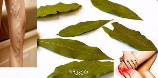 არ არის ვარიკოზული ვენები, შაკიკი და მეხსიერების პრობლემები: და ამ ბროშურას შეუძლია ამ ყველაფრის აღმოფხვრა