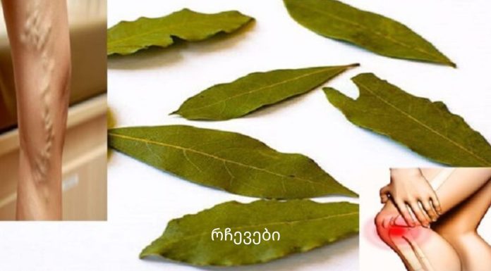 არ არის ვარიკოზული ვენები, შაკიკი და მეხსიერების პრობლემები: და ამ ბროშურას შეუძლია ამ ყველაფრის აღმოფხვრა