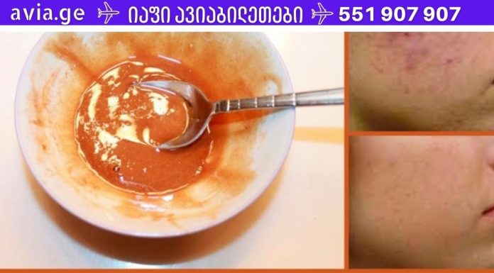 მოიშორეთ სახეზე არსებული ნაწიბურები და ლაქები ამ ნიღბით!