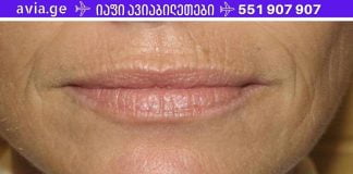 წარმოუდგენელი! ეს მეთოდი ძალიან სწრაფად დაეხმარა ტუჩის ზემოთ ნაოჭების მოშორებას!