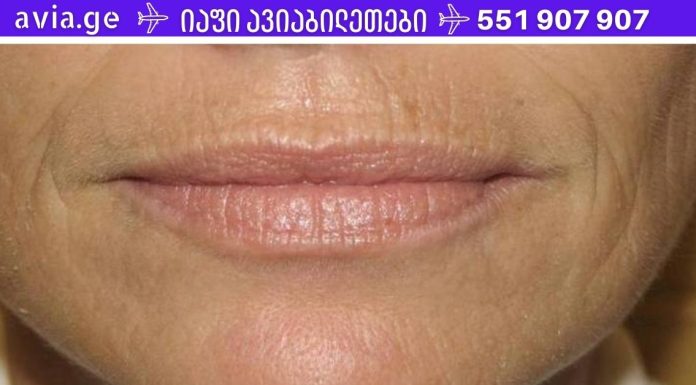 წარმოუდგენელი! ეს მეთოდი ძალიან სწრაფად დაეხმარა ტუჩის ზემოთ ნაოჭების მოშორებას!