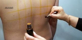 რა ნიშნებს უნდა მიაქციოთ ყურადღება იოდის დეფიციტის დროს!