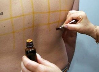 რა ნიშნებს უნდა მიაქციოთ ყურადღება იოდის დეფიციტის დროს!