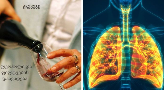 რა კავშირშია ფილტვების ობსტრუქციული დაავადება ალკოჰოლთან.იხილეთ სტატიაში ვრცლად.