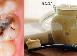 ეს 5 ხრიკი დაგეხმარებათ გათავისუფლდეთ კბილებთან დაკავშირებული მრავალი პრობლემისგან!