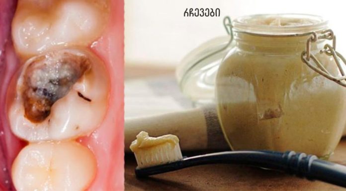 ეს 5 ხრიკი დაგეხმარებათ გათავისუფლდეთ კბილებთან დაკავშირებული მრავალი პრობლემისგან!