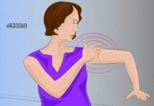 ინსულტის სიმპტომები, რომლებიც ქალებმა ყველაზე მეტად უნდა იცოდნენ