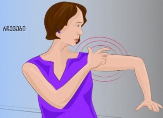 ინსულტის სიმპტომები, რომლებიც ქალებმა ყველაზე მეტად უნდა იცოდნენ