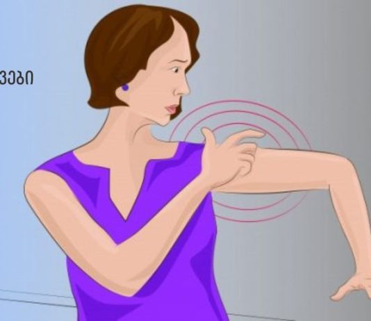 ინსულტის სიმპტომები, რომლებიც ქალებმა ყველაზე მეტად უნდა იცოდნენ