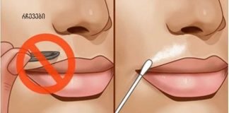 დაემშვიდობეთ სახეზე თმას ამ მარტივი ხელნაკეთი რეცეპტებით