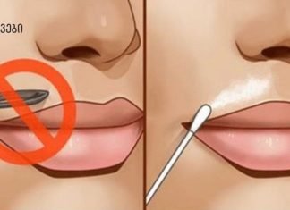 დაემშვიდობეთ სახეზე თმას ამ მარტივი ხელნაკეთი რეცეპტებით