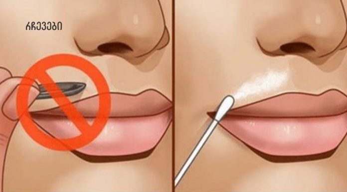 დაემშვიდობეთ სახეზე თმას ამ მარტივი ხელნაკეთი რეცეპტებით