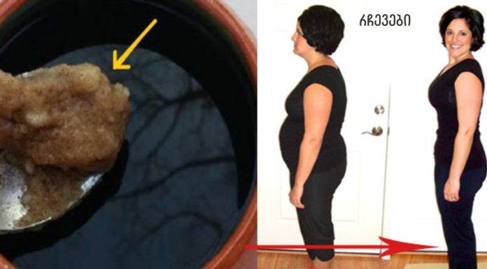 ჩაყარეთ ეს ორი ინგრედიენტი თქვენს ყავაში – სულ რაღაც 2 კოვზის შემდეგ, მუცლის ცხიმი გაქრება და თქვენი მეტაბოლიზმი უფრო სწრაფი იქნება, ვიდრე ოდესმე (რეცეპტი)!