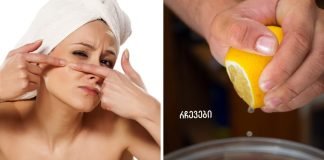 როგორ დავხუროთ ფორები სახეზე? 10 ეფექტური რჩევა,რომელიც დაგეხმარებათ პრობლემის თავიდან აცილებაში!