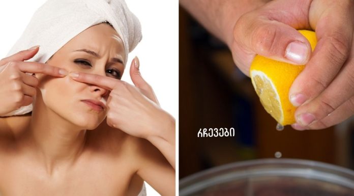 როგორ დავხუროთ ფორები სახეზე? 10 ეფექტური რჩევა,რომელიც დაგეხმარებათ პრობლემის თავიდან აცილებაში!