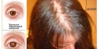 E ვიტამინის დეფიციტის 7 ძირითადი ნიშანი, რომელიც არასოდეს არ უნდა უგულებელყოთ!