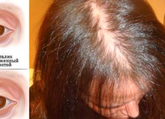 E ვიტამინის დეფიციტის 7 ძირითადი ნიშანი, რომელიც არასოდეს არ უნდა უგულებელყოთ!