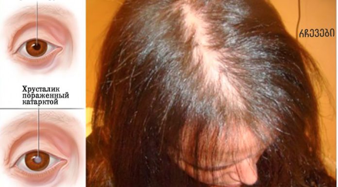 E ვიტამინის დეფიციტის 7 ძირითადი ნიშანი, რომელიც არასოდეს არ უნდა უგულებელყოთ!