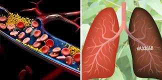 9 მცენარე და ბალახი, რომელიც აღადგენს დაზიანებულ ფილტვებს, ებრძვის ინფექციებს და აძლიერებს ფილტვების ჯანმრთელობას