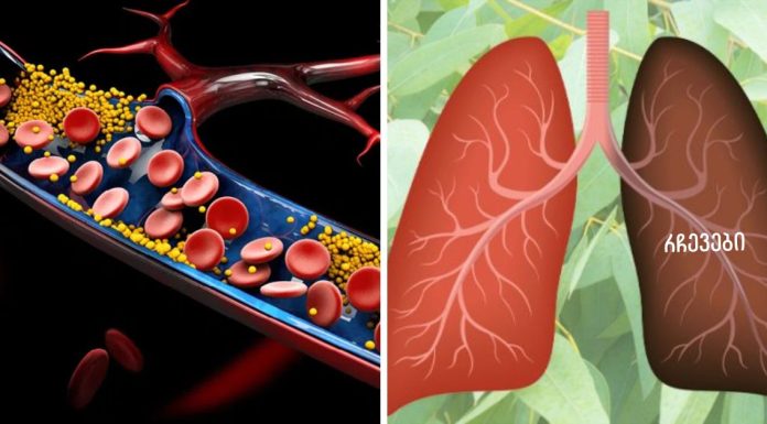 9 მცენარე და ბალახი, რომელიც აღადგენს დაზიანებულ ფილტვებს, ებრძვის ინფექციებს და აძლიერებს ფილტვების ჯანმრთელობას