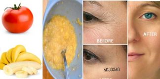 მოიშორეთ სახის ნაოჭები 3 დღეში ამ 3 ინგრედიენტიანი მალამოთი.