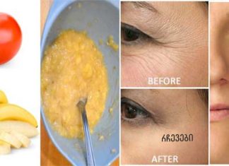 მოიშორეთ სახის ნაოჭები 3 დღეში ამ 3 ინგრედიენტიანი მალამოთი.