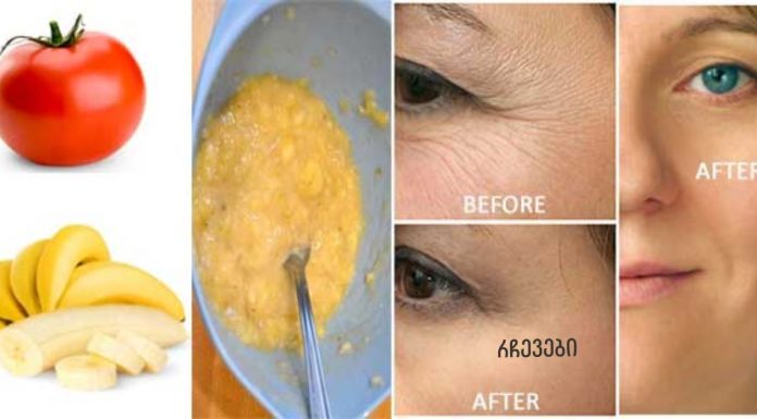 მოიშორეთ სახის ნაოჭები 3 დღეში ამ 3 ინგრედიენტიანი მალამოთი.