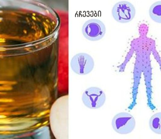 იყენებთ ვაშლის ძმარს? გაარკვიეთ, როგორ დალიოთ ის, რომ ზიანი არ მიაყენოთ თქვენს ჯანმრთელობას!