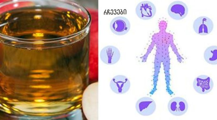 იყენებთ ვაშლის ძმარს? გაარკვიეთ, როგორ დალიოთ ის, რომ ზიანი არ მიაყენოთ თქვენს ჯანმრთელობას!