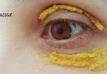 5 დღის განმავლობაში თვალის ირგვლივ კურკუმას ისვამდა! და ასეც მოხდა!