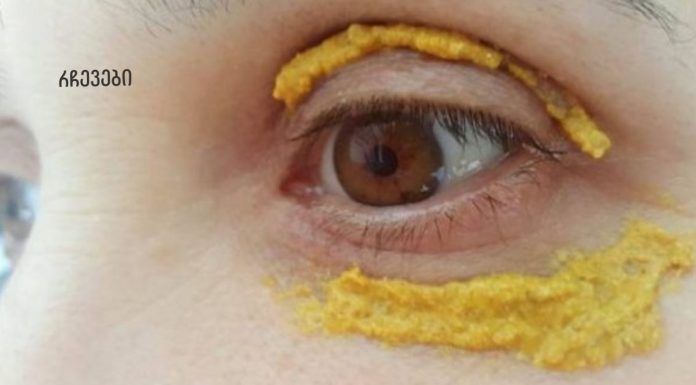 5 დღის განმავლობაში თვალის ირგვლივ კურკუმას ისვამდა! და ასეც მოხდა!