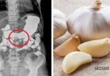 ნახეთ, რა მოხდება, როცა 7 დღის განმავლობაში უზმოზე მიირთმევთ ნიორსა და თაფლს!