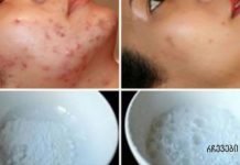 სახის ნიღაბი, რომელიც ჯადოსნურად აშორებს აკნეს, ნაწიბურებს და ნაოჭებს მეორე გამოყენების შემდეგ