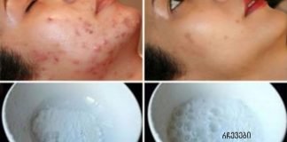 სახის ნიღაბი, რომელიც ჯადოსნურად აშორებს აკნეს, ნაწიბურებს და ნაოჭებს მეორე გამოყენების შემდეგ