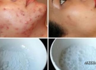 სახის ნიღაბი, რომელიც ჯადოსნურად აშორებს აკნეს, ნაწიბურებს და ნაოჭებს მეორე გამოყენების შემდეგ