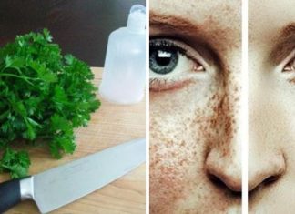 გამოიყენეთ ამ მცენარის ფოთლები ნაოჭების, აკნეს, მუქი ლაქების და მზის ალერგიის წინააღმდეგ ბრძოლაში.