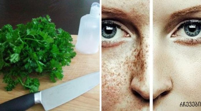 გამოიყენეთ ამ მცენარის ფოთლები ნაოჭების, აკნეს, მუქი ლაქების და მზის ალერგიის წინააღმდეგ ბრძოლაში.