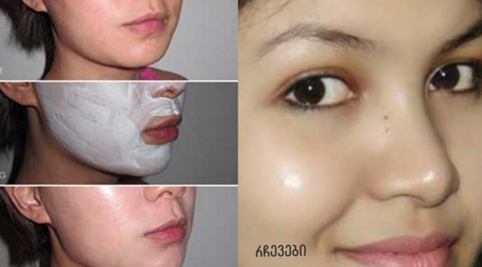 გამოიყენეთ ეს სახის კრემი ზედიზედ 3 ღამე და მიიღეთ მბზინავი კანი, იცხოვრეთ ლაქების გარეშე