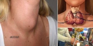 ექიმები ამას არასოდეს გეტყვიან: აი, როგორ განკურნოთ ფარისებრი ჯირკვალი მხოლოდ ერთი ინგრედიენტით!