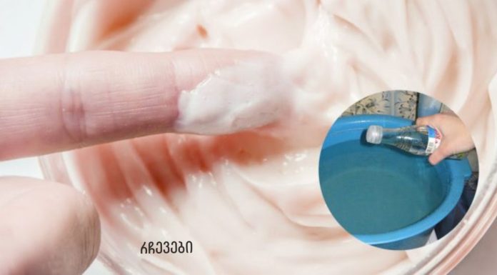 აქ ქალბატონს მისმა ბებიის რეცეპტმა უშველა.ამ ხალხური საშუალებით ფეხებზე და მკლავებზე სოკო ქრება. მყისიერი შედეგი!