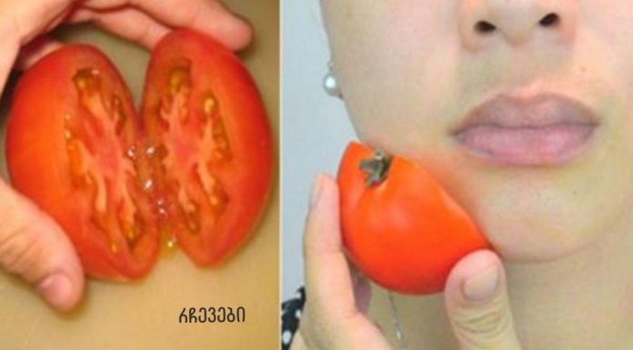 როგორ გამოვიყენოთ პომიდორი აკნეს სწორად სამკურნალოდ