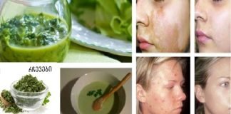 დაემშვიდობეთ მუქ ლაქებს და ჭორფლებს: ეს ინგრედიენტი მოგაშორებთ მათ