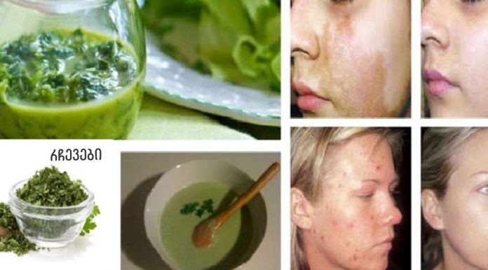 დაემშვიდობეთ მუქ ლაქებს და ჭორფლებს: ეს ინგრედიენტი მოგაშორებთ მათ