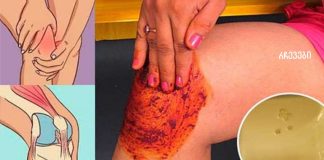 ხალხი გიჟდება ამ რეცეპტზე! კურნავს მუხლის, ძვლებისა და სახსრების ტკივილს!