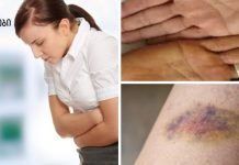 ყურადღება! პირველი 7 ნიშანი იმისა, რომ თქვენი ღვიძლი ძლიერ დაზიანებულია!