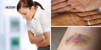 ყურადღება! პირველი 7 ნიშანი იმისა, რომ თქვენი ღვიძლი ძლიერ დაზიანებულია!